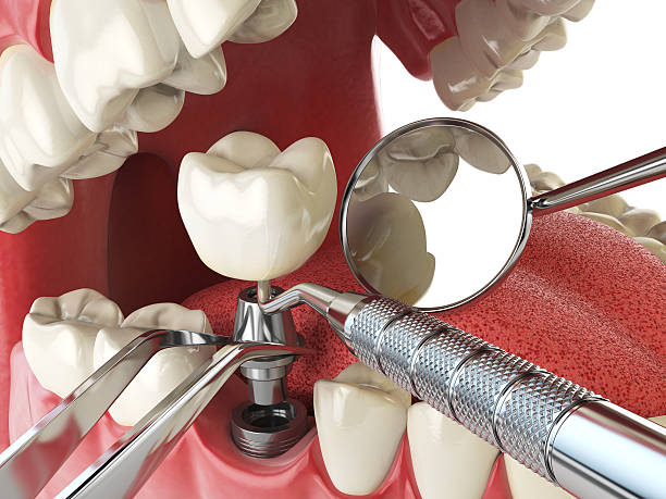 Emergency Dental Services for Seniors